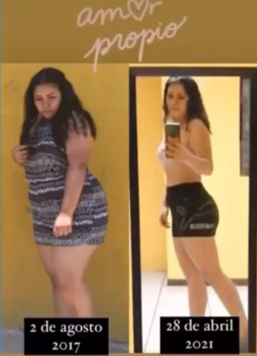 Antes y después de un paciente