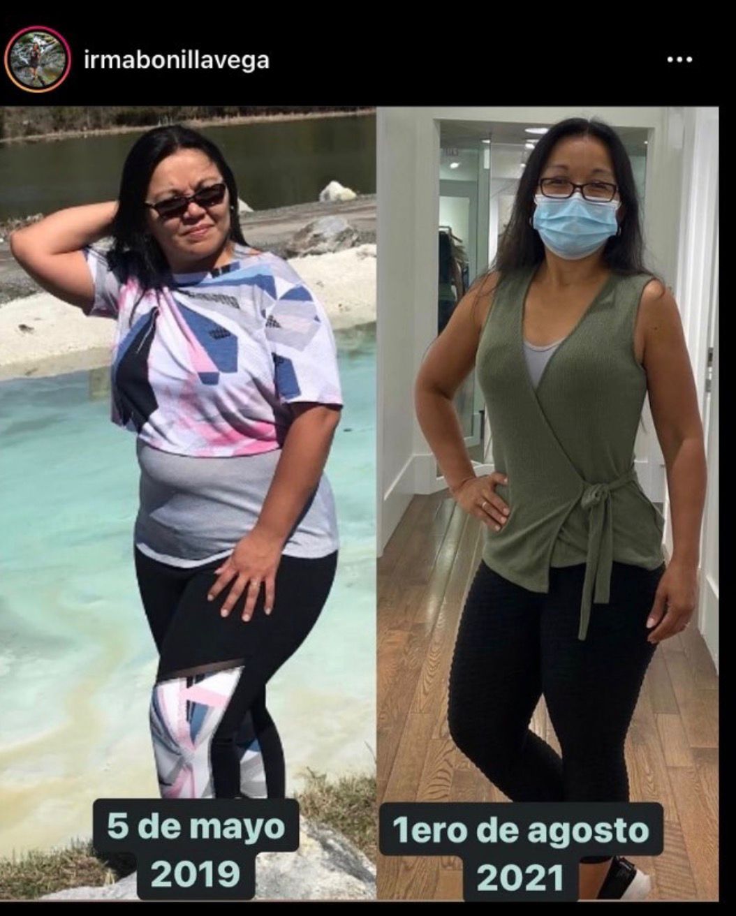 Antes y después de un paciente
